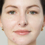 ARNICA ALL-COVER POT