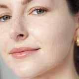 ARNICA ALL-COVER POT