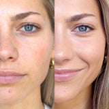 ARNICA ALL-COVER POT