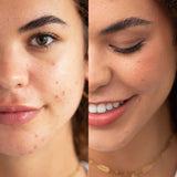 ARNICA ALL-COVER POT