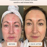SEA BUCKTHORN SERUM -  SUN SPOT SERUM