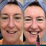 Beauty Reset Drops