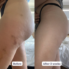 Native Collagen Booster