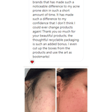 Acne Away Set