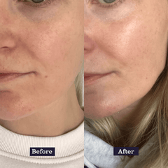 Ageless Skincare - Essentials Set