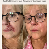 SEA BUCKTHORN SERUM -  SUN SPOT SERUM