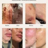 SEA BUCKTHORN SERUM -  SUN SPOT SERUM