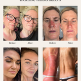 SEA BUCKTHORN SERUM (100ml)