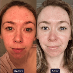 Broccoli Blue Light Revitalise Booster Serum