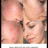Edible Beauty Core Four