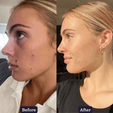 Inner Essentials – Skin + Gut Renew Powder