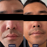 Microbiome Calming Milk Booster Serum