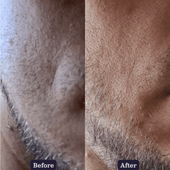 Native Collagen Booster