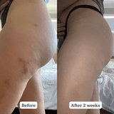 Native Collagen Booster