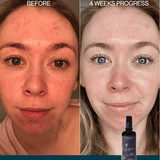 No.2 Citrus Rhapsody Toner Mist Double Deal