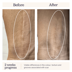Phyto Stretch Mark Oil