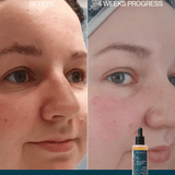 Plant Collagen Plumping Booster Serum