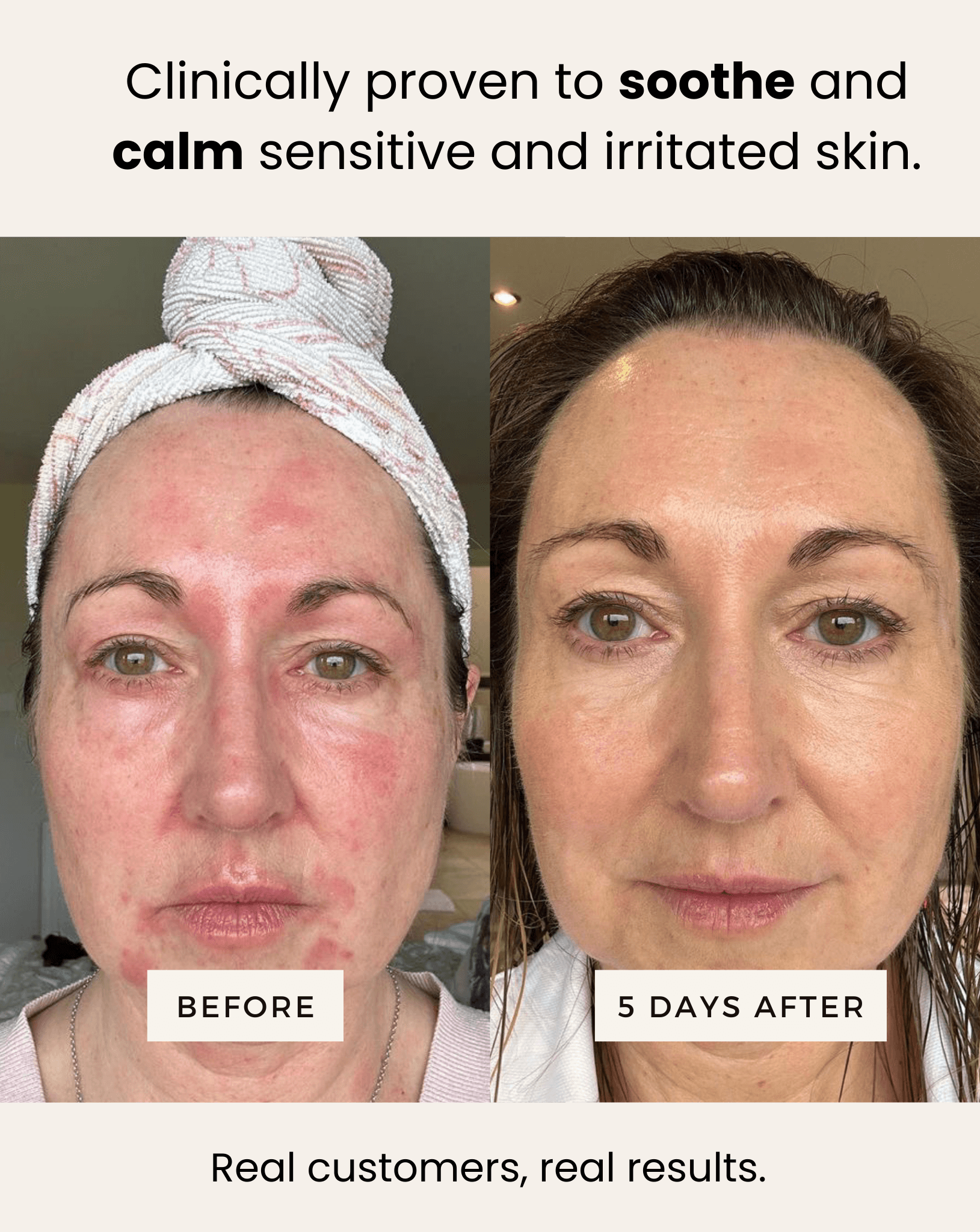 SEA BUCKTHORN SERUM -  SUN SPOT SERUM