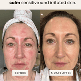 SEA BUCKTHORN SERUM (5ml)