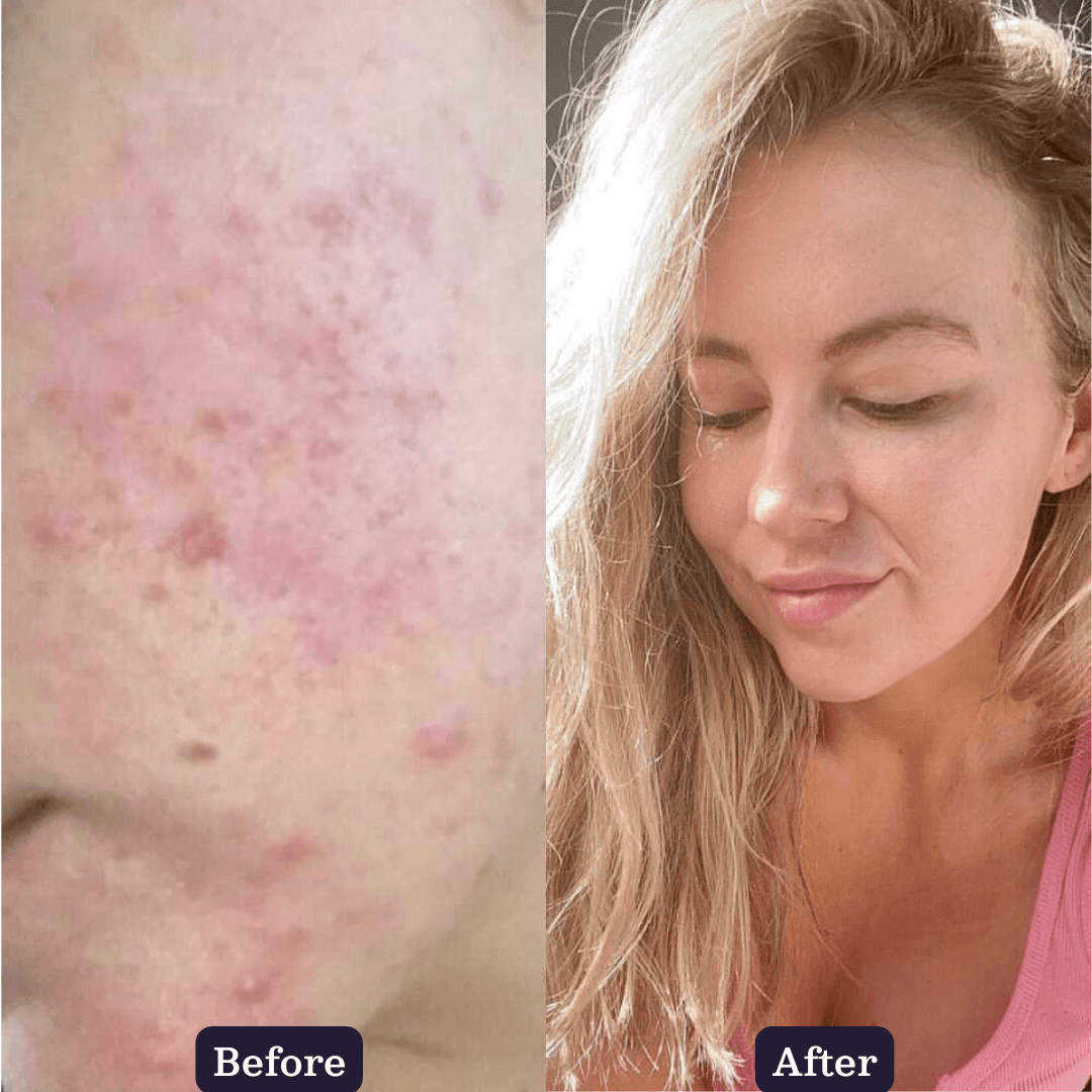 Tumeric Brightner Turmeric Brightening Booster Serum – I Am Natural Store
