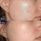 Turmeric Brightening Booster Serum
