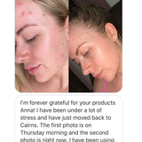 Turmeric Brightening Booster Serum
