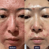 Turmeric Brightening Booster Serum